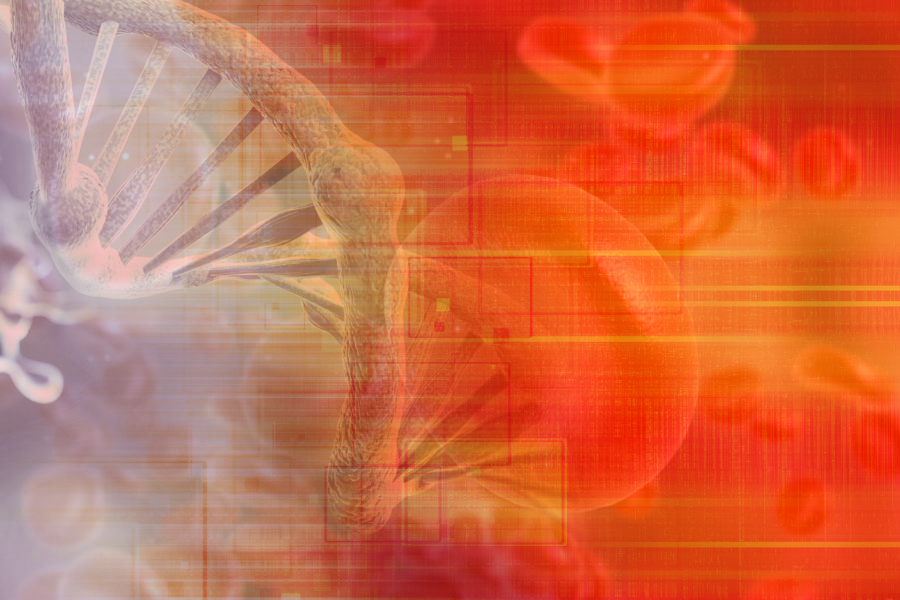 Webinar - Acute Myelogenous Leukemia: Treatment Updates and